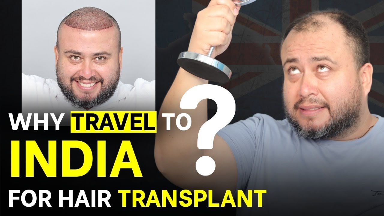 FUE Hair Transplant (HX-MILQ) | Best Cost & Results of FUE Hair Transplant