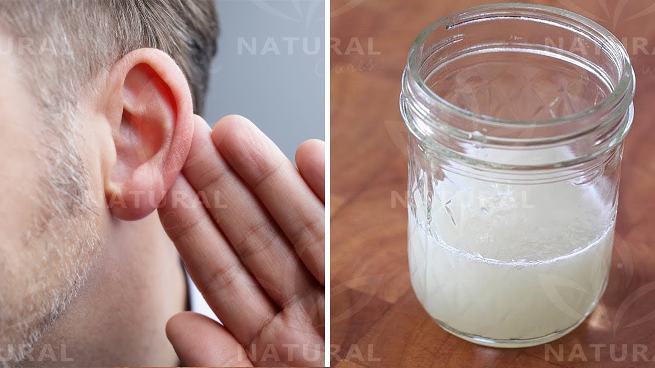 Garlic and Onion Can Restore Hearing Loss, Here's How... YouTube