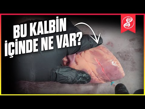 Video: Krizin başqa adı varmı?