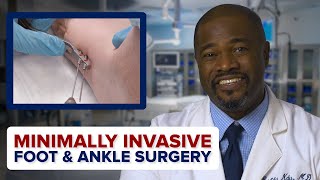 Minimally Invasive Foot &amp; Ankle Surgery | Penn Orthopaedics