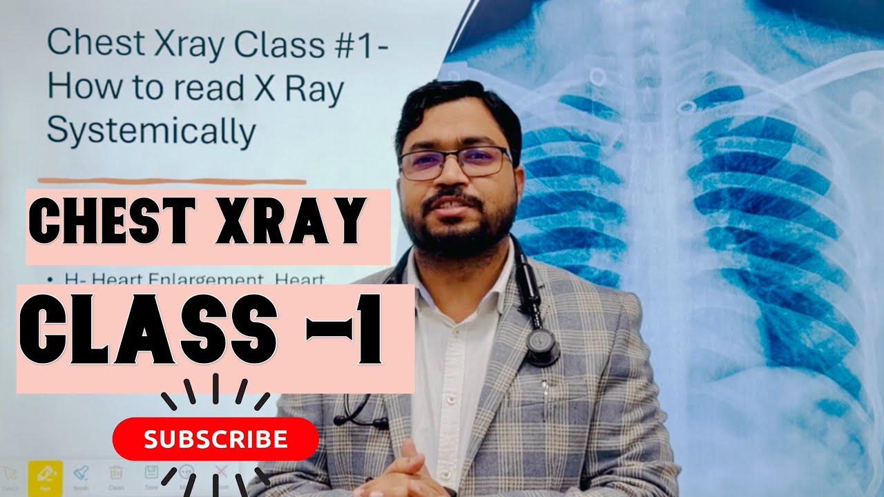 “Chest Xray Classes #1 - How to read Xray in systemic way”