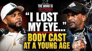 Pt 2 Charleston White Reveals How He Lost His Eye & Ended Up in a Body Cast