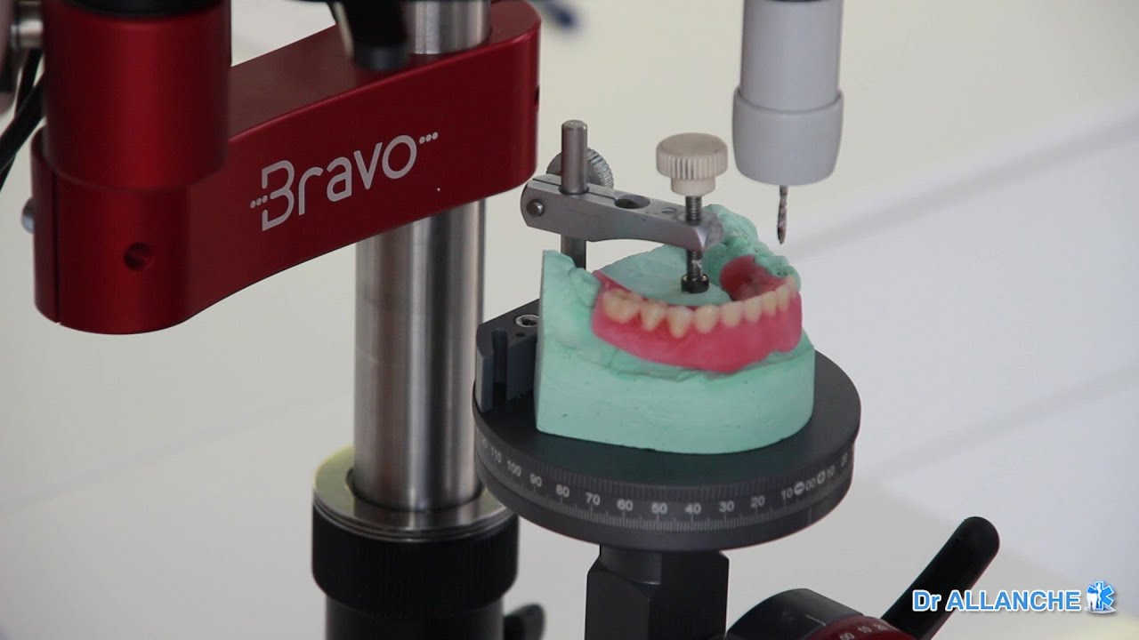 Planification implantaire 3d avec la fraiseuse bravo