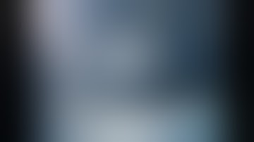 Robotic full-thickness resection lesser curvature gastric GIST near GE junction.