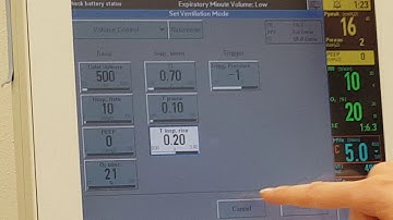 Servo i Skill 3c d Initiate VC adjust alarms and chart 1