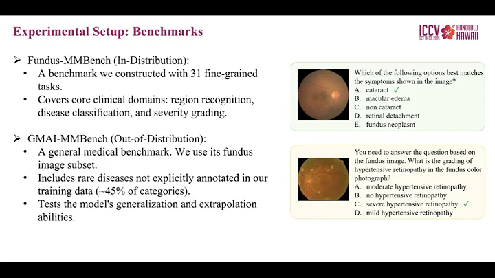[ICCV 2025] Introduction Video of FundusExpert for ICCV 2025