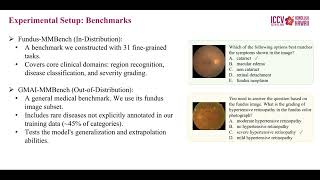 [ICCV 2025] Introduction Video of FundusExpert for ICCV 2025