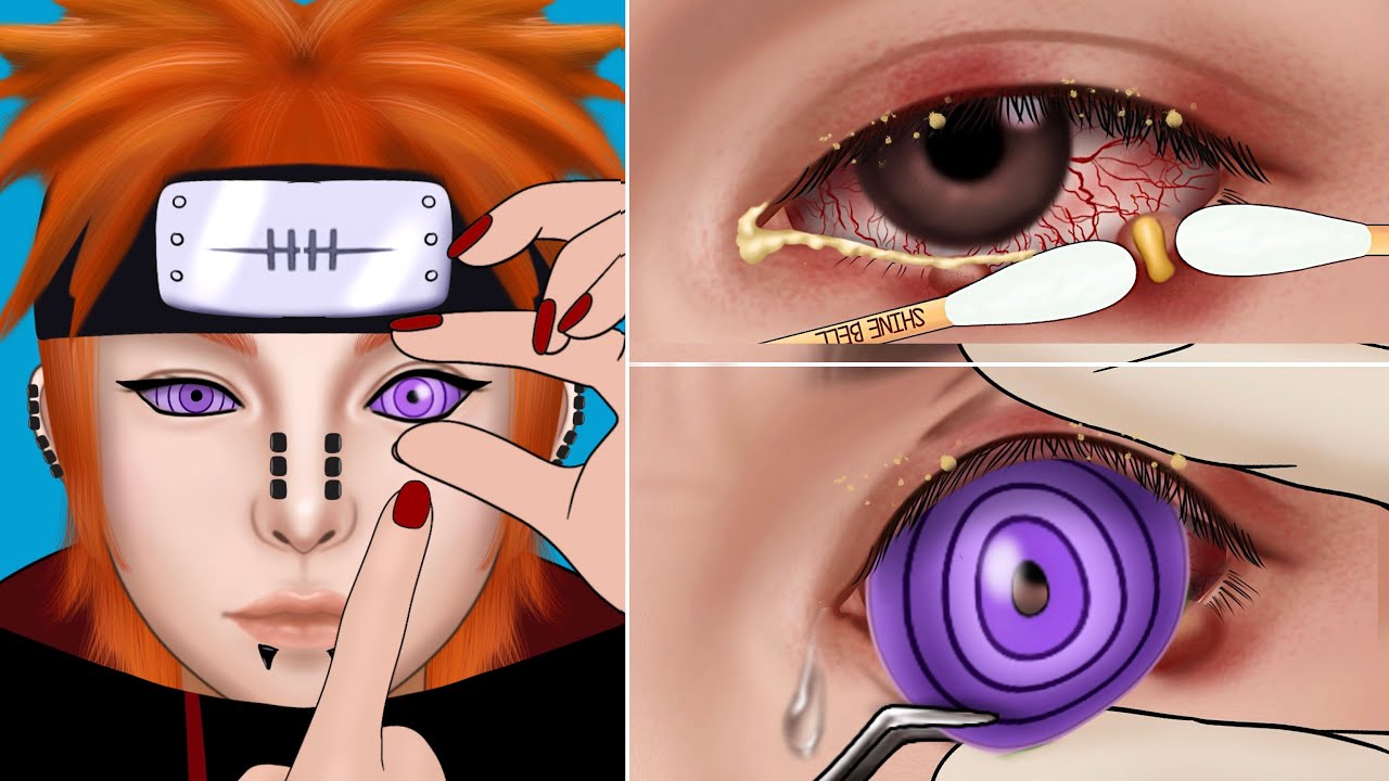 ASMR Removal of Very Big Contact Lenses from the eye 👁 Animation