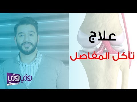 علاج تآكل المفاصل