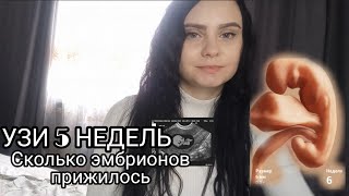 ПЕРВОЕ УЗИ БЕРЕМЕННОСТИ🤰5 НЕДЕЛЬ 👶👶 Двойня или один ? Результат ЭКО.