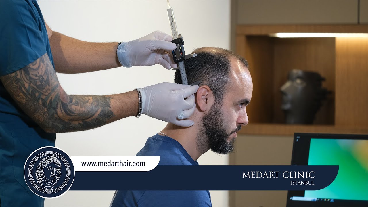 Hair Transplant Turkey Medart Hair Clinic Istanbul YouTube