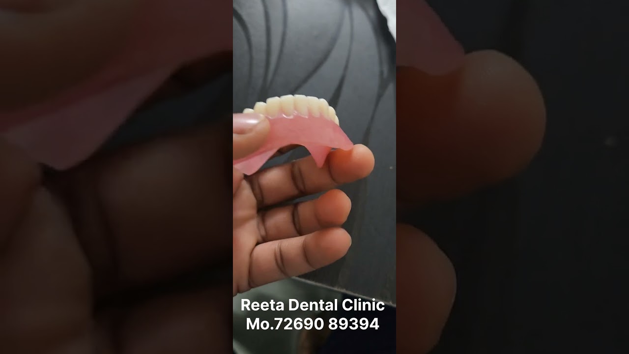 RPD Lower Full😬 Teeth 