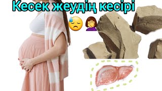 Пирсинг пен татуировкасы бар кисканың суреттері