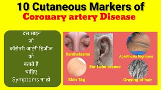 Cutaneous Marker/Skin marker of Coronary artery Disease II How to detect early CADll Hindi हिंदी मे