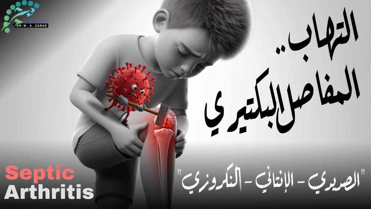 Септический артрит | Когда сустав заканчивается через 3 дня