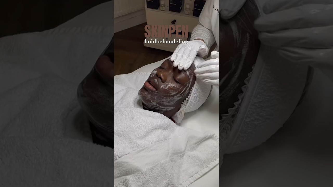 SkinPen huidbehandeling voor de donkere huid 