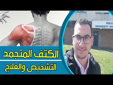 فيديو: 3 طرق لتشخيص الكتف المتجمد