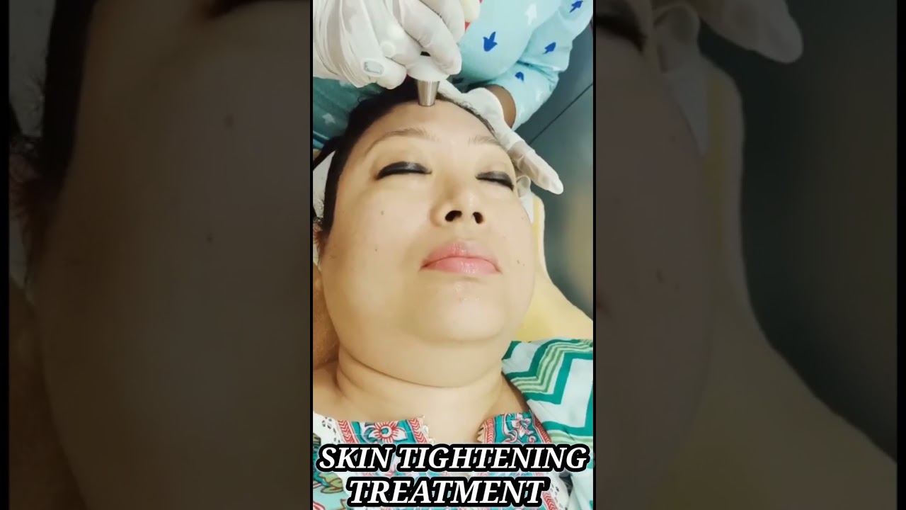 DIAMOND POLAR TREATMENT | SKIN TIGHTENING TREATMENT| 