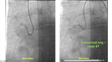 8.2 PCI - Wiring key principles