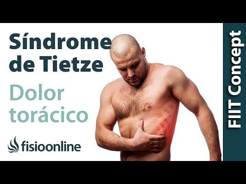 Video: Sindrome Di Tietze: Cause, Sintomi, Trattamento