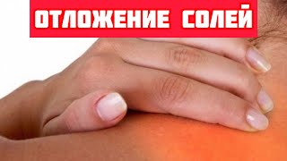 Замучила боль в шее,шум в ушах? Как излечить шейный остеохондроз,убрать отложение солей,обычным….