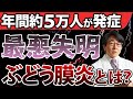 ぶどう膜炎 放置していると合併症や後遺症の危険も ぶどう膜炎 放置していると合併症や後遺症の危険も