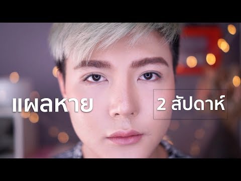 เคล็ดลับ ลดเลือน/ป้องกันรอยแผลเป็นนูน คีลอยด์ภายใน 2 สัปดาห์ | Bryan Tan