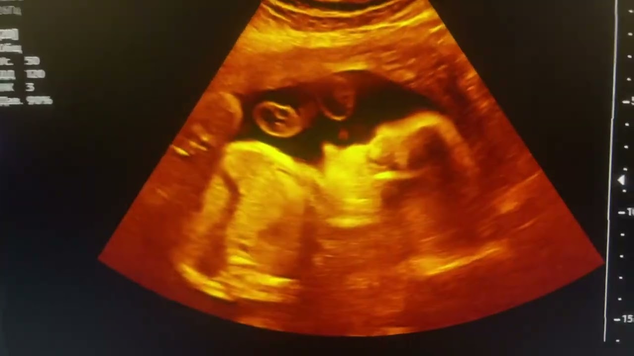 МАЛУМОТ УЧУН ФАКАТ ТЕЛЕГРАМДАН ЁЗИНГ: +998950014004 