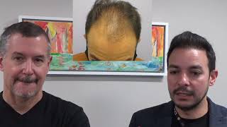 Life changing hair transplant experience, interview with Dr. Lindsey hair patient in Washington | DC
