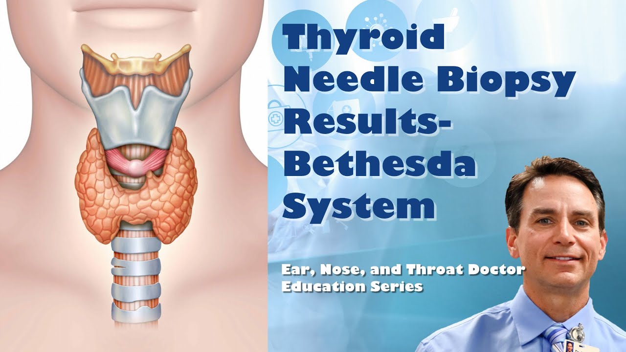 Thyroid Needle Biopsy Results Bethesda Classification System YouTube