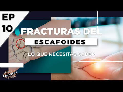 Video: ¿Por qué se ordenan las series de escafoides?