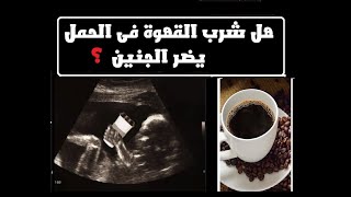 هل شرب القهوة أمن في الحمل؟ ومالحد المسموح؟