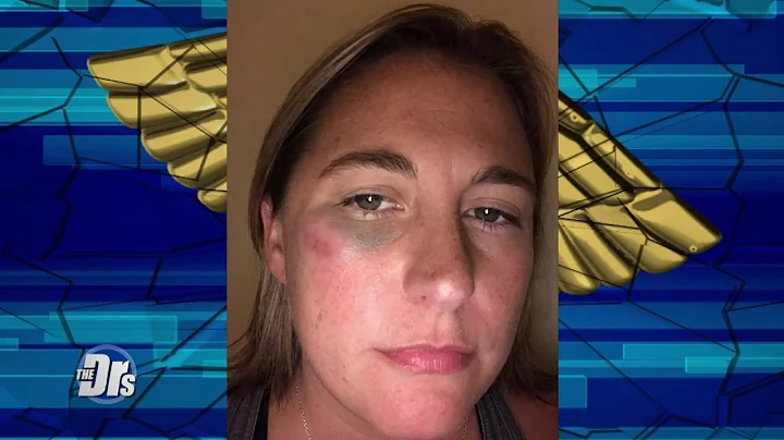 Nurses Being Attacked at Work