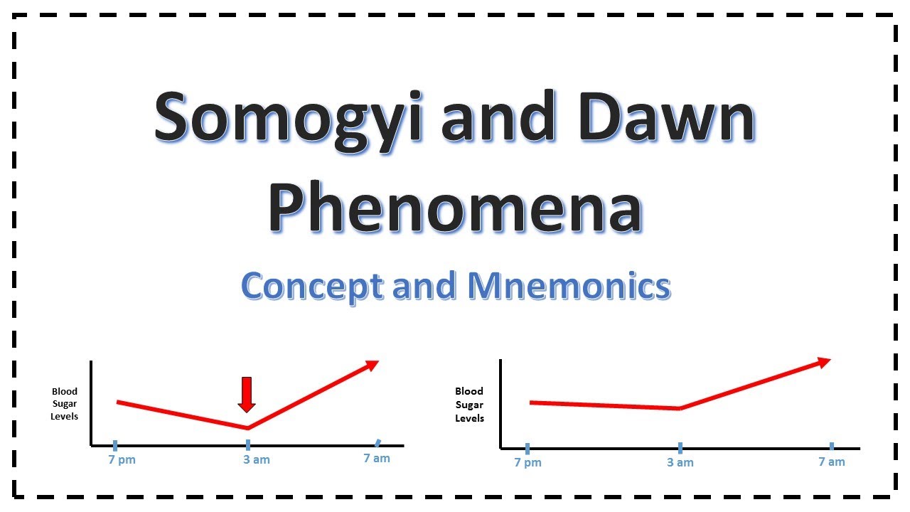 phenomena vs phenomenon