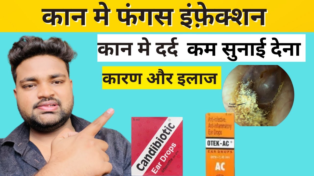 कान मे दर्द, बहना और कम सुनाई देना / Ear Fungus Infection Causes And