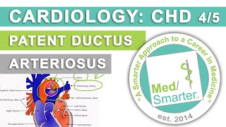 USMLE Step 1 | Congenital Heart Diseases - Cardiology | MedSmarter | Part 4 of 5