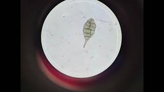 Microscopic view of Alternaria alternata