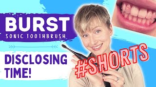 Burst Disclosing Time Unsponsored Review