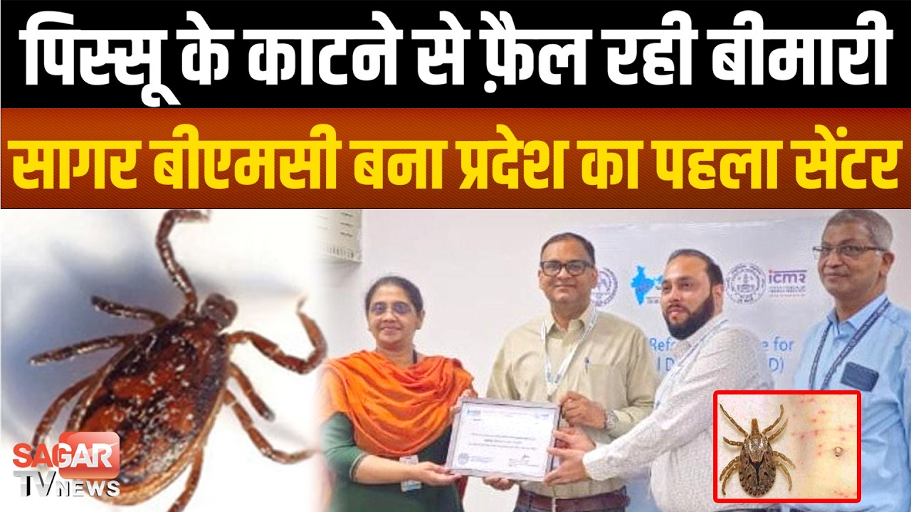 Sagar- बुखार के साथ शरीर पर आ रहे है क्या सिगरेट के जलने जैसे निशान, तो रहे सावधान| SAGAR TV NEWS |