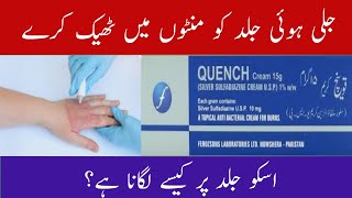 Quench Cream Uses in Urdu/Hindi | Best Cream For Burns | Silver Sulphadiazine Cream Uses in Urdu