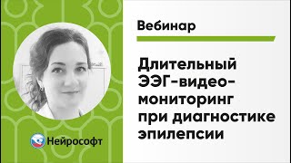 Длительный ЭЭГ-видеомониторинг при диагностике эпилепсии