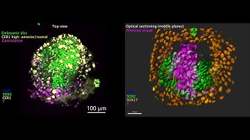 Researchers generate human embryo-like structures that include extraembryonic tissue