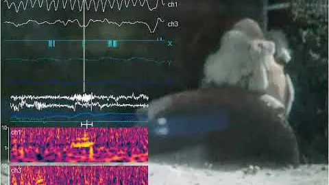 A Day Octopus, Octopus cyanea, Sleeps in a Tank While Its Brain Activity Is Recorded