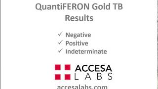 TB Blood Test: QuantiFERON Gold TB Blood Test Results Overview by Accesa Labs 114,331 views 7 years ago 1 minute, 57 seconds