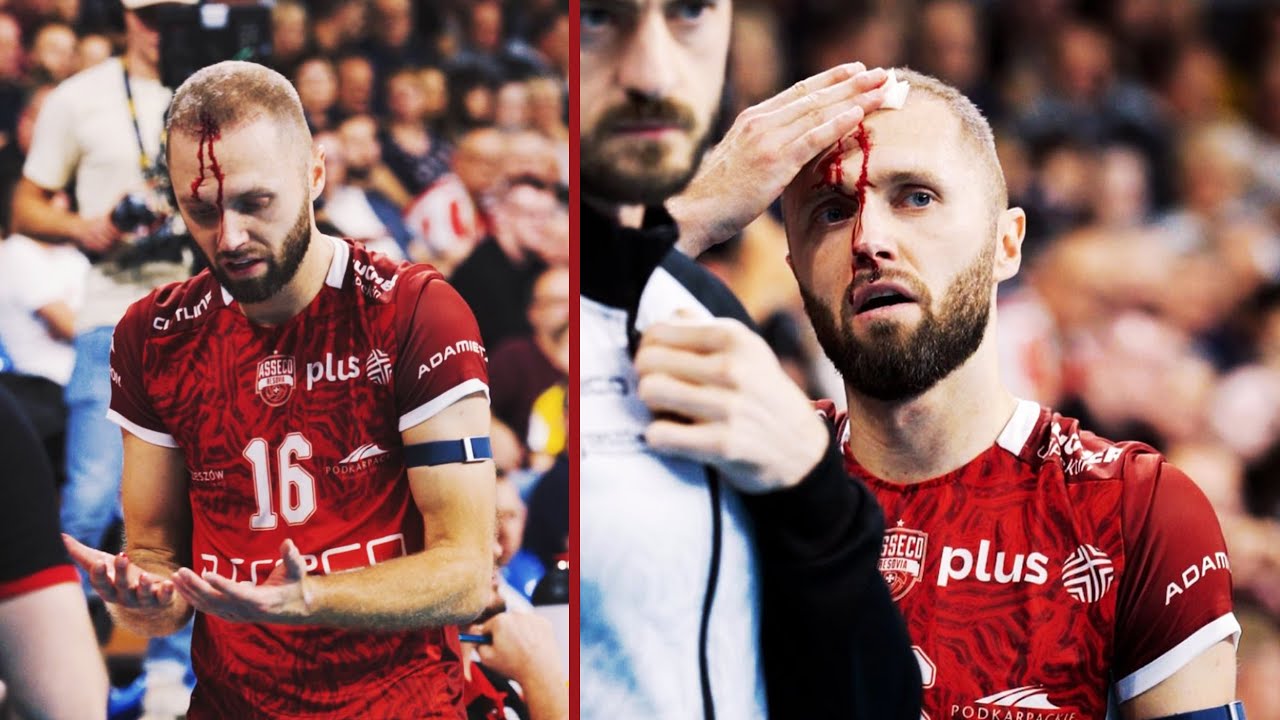 Dark Side of Volleyball | Volleyball Injuries & Dangerous Moments