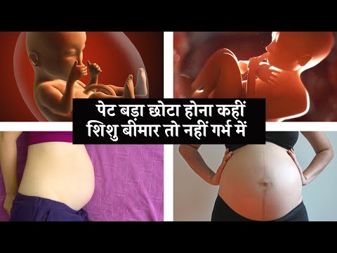 गर्भावस्था में पेट बड़ा या छोटा होना क्या चिंता का विषय हैं Big or Small Belly for Pregnant Women