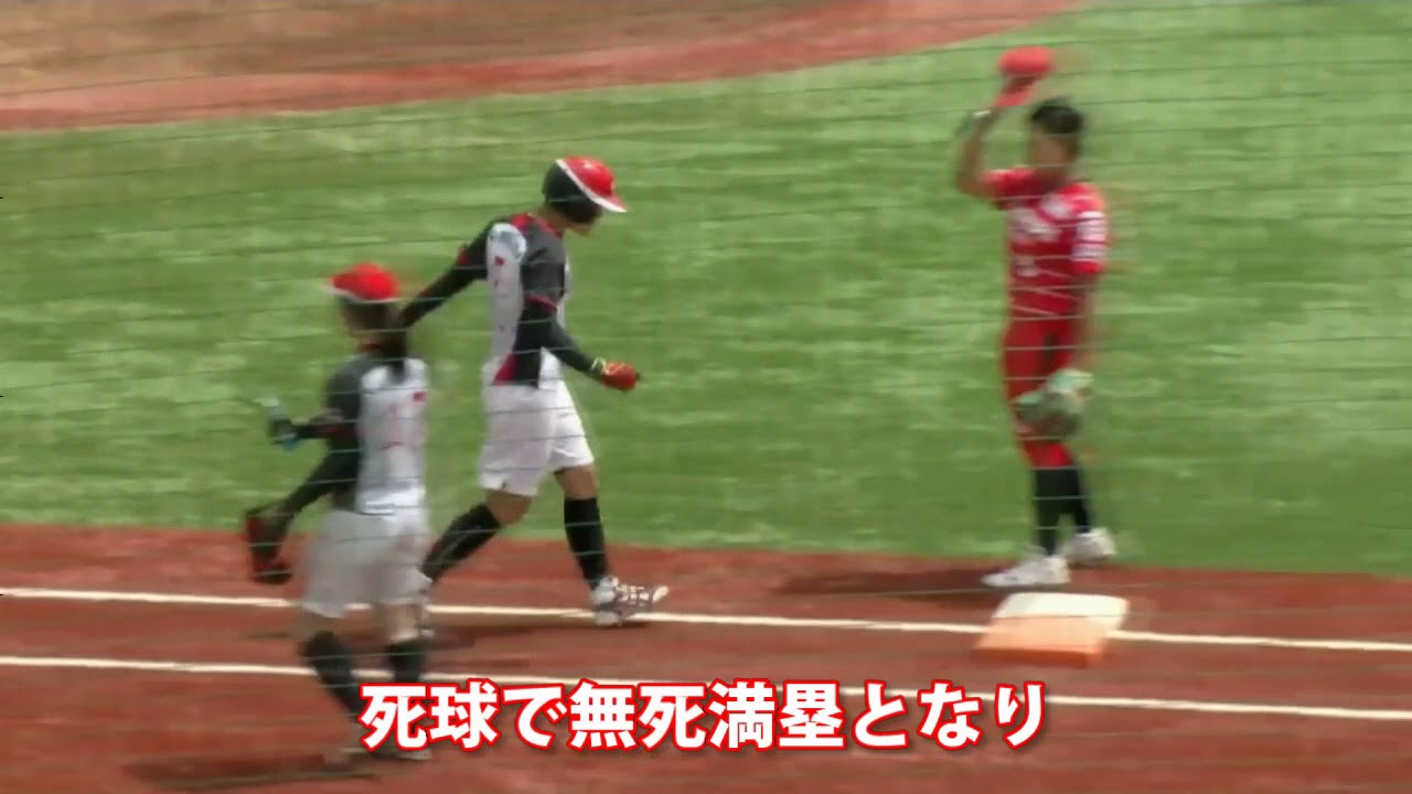 ソフトボール上野由岐子顔面骨折か 打球が顔面を直撃した Wadai