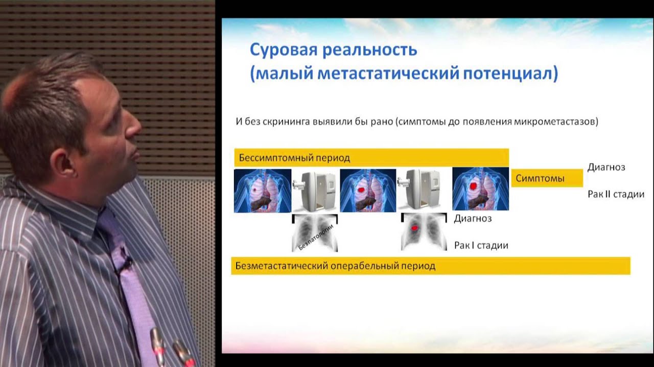 townstream - Н.В.Жуков "Рак легкого. Эпидемиология, факторы риска ...