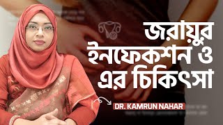 জরায়ুর ইনফেকশন: লক্ষণ, করণীয় ও চিকিৎসা : Dr. Kamrun Nahar| LifeSpring