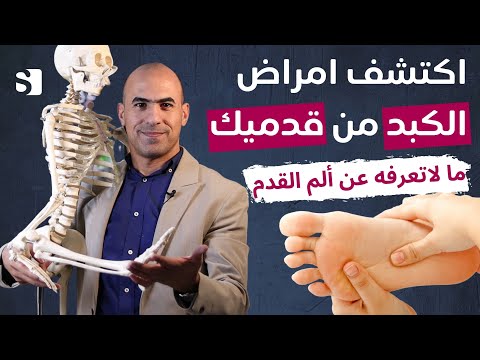 فيديو: مشاكل الكب - كيفية إصلاح مشكلة القدم المنكمشة